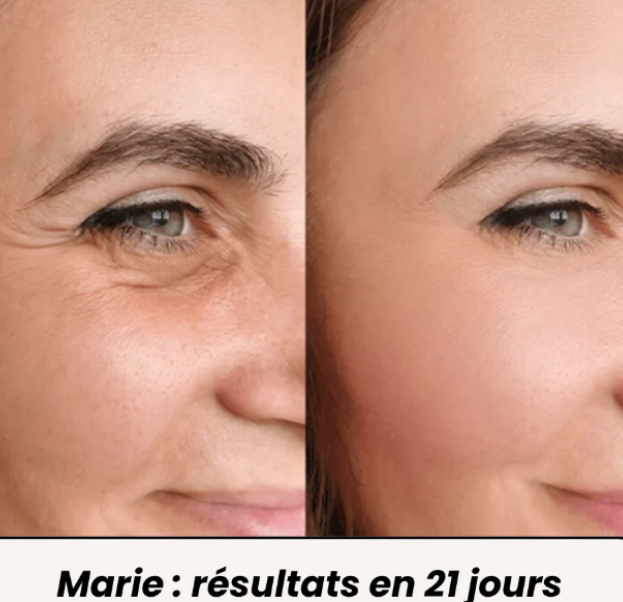 NIVORA – Crème Contour des Yeux Led 2 en 1- Anti-Cernes et Raffermissante